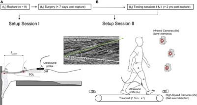 Altered Gastrocnemius Contractile Behavior in Former <mark class="highlighted">Achilles Tendon Rupture</mark> Patients During Walking